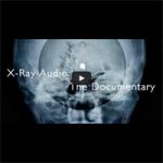 Dokumentation: X-Ray Audio
